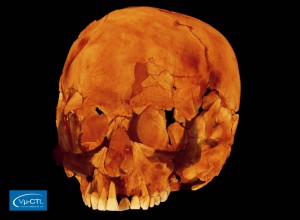 Schädel eines anatomisch modernen Menschen aus Israel, ca. 100.000 Jahre alt, Auflösung 70µm