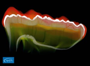 Zahn eines Höhlenbären (Ursus spelaeus), geschnitten, Schmelz und Dentin sind sichtbar, Auflösung 21.5µm